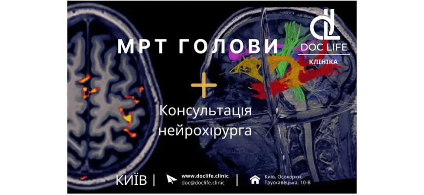 МРТ голови - МРТ головного мозку в Києві клініка МРТ Док Лайф